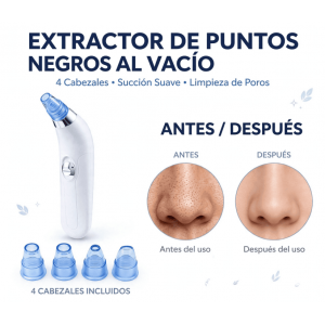 Extractor de Puntos Negros al Vacío - Limpiador de Poros con 4 Cabezales - Succión Suave Recargable - Belleza Facia