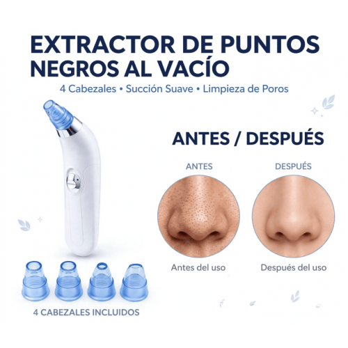 Extractor de Puntos Negros al Vacío - Limpiador de Poros con 4 Cabezales - Succión Suave Recargable - Belleza Facia Extractor de Puntos Negros al Vacío - Limpiador de Poros con 4 Cabezales - Succión Suave Recargable - Belleza Facia