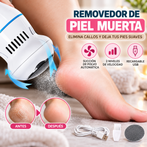 Removedor Eléctrico de Callos y Piel Muerta para Pies con Aspiración y 2 Velocidades por Mayoreo