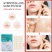 Parche facial de acné hidrocoloide invisible de 72 piezas W-MQD6994