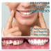 Carillas dentales removibles tipo Snap On Smile que mejoran la estética de la sonrisa al instante. Uso temporal y estético. Venta al por mayor ZE-2042